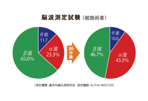 脳波測定の試験画像